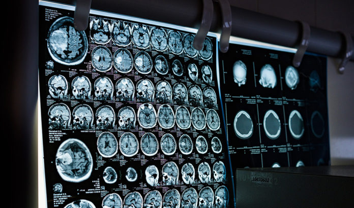 163914159603910neuroEST